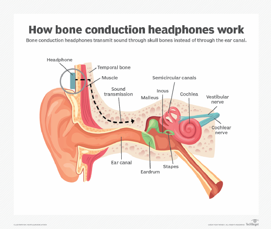 Illustration of bone conduction technology in earbuds